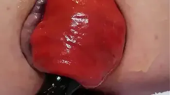 Contender For Biggest Prolapse (Male Warning!)