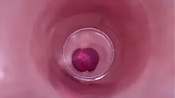 Female Insemination - Internal Camera Captures Deep Male Ejaculation