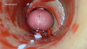 Camera Inside Deep Pussy Captures Dose Ejaculation of Sperm ASMR
